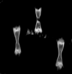 TGV X-ray Inspection
